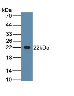 Invitrogen™ Beta-casein Polyclonal Antibody