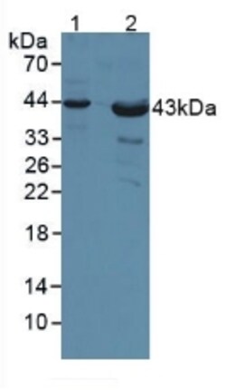 Invitrogen&trade;&nbsp;CD155 Polyclonal Antibody