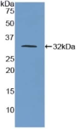 Invitrogen™ CD155 Polyclonal Antibody