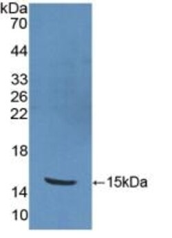 Invitrogen&trade;&nbsp;PKIB Polyclonal Antibody