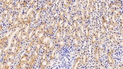 Invitrogen&trade;&nbsp;DVL1 Polyclonal Antibody