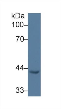 Invitrogen&trade;&nbsp;EGR3 Polyclonal Antibody