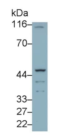 Invitrogen™ TBXA2R Polyclonal Antibody
