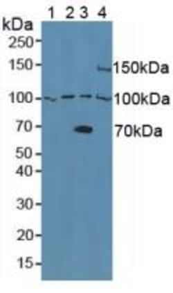 Invitrogen&trade;&nbsp;ADAM8 Polyclonal Antibody