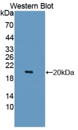 Invitrogen™ LECT2 Polyclonal Antibody
