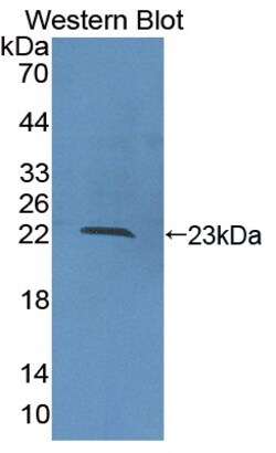 Invitrogen&trade;&nbsp;COL16A1 Polyclonal Antibody