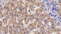 Invitrogen™ SAA Polyclonal Antibody