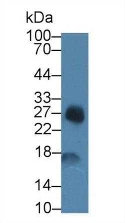 Invitrogen&trade;&nbsp;SAA Polyclonal Antibody