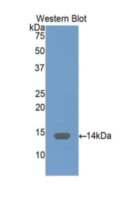 Invitrogen&trade;&nbsp;SAA Polyclonal Antibody