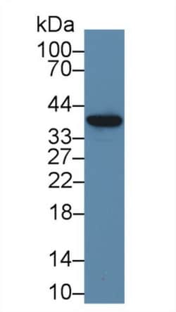 Invitrogen™ MT-ND1 Polyclonal Antibody