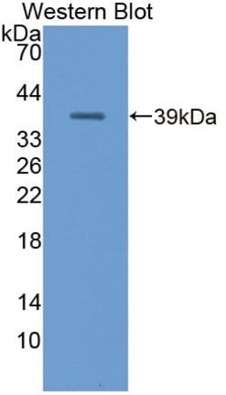Invitrogen&trade;&nbsp;MT-ND1 Polyclonal Antibody