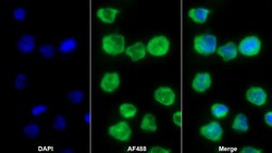 Invitrogen&trade;&nbsp;CD31 Polyclonal Antibody