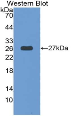 Invitrogen™ THSD7A Polyclonal Antibody