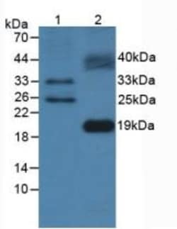 Invitrogen&trade;&nbsp;FLT3LG Polyclonal Antibody