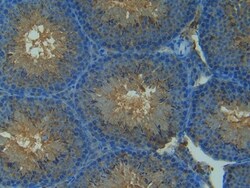 Invitrogen&trade;&nbsp;iNOS Polyclonal Antibody