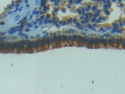 Invitrogen&trade;&nbsp;iNOS Polyclonal Antibody