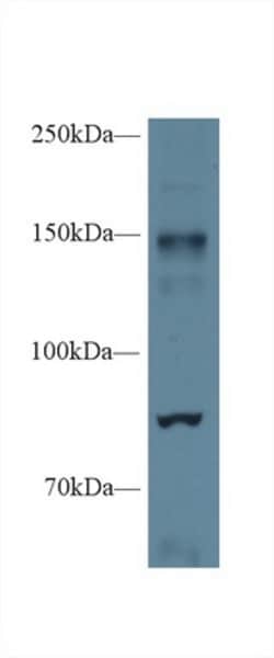 Invitrogen&trade;&nbsp;iNOS Polyclonal Antibody
