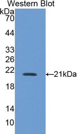 Invitrogen&trade;&nbsp;iNOS Polyclonal Antibody