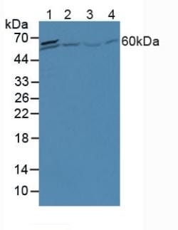 Invitrogen™ A1CF Polyclonal Antibody