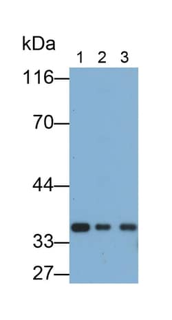 Invitrogen&trade;&nbsp;SMN1 Polyclonal Antibody