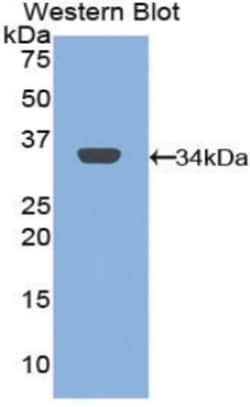 Invitrogen™ CD206 Polyclonal Antibody