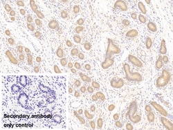 Invitrogen&trade;&nbsp;PTPRM Polyclonal Antibody