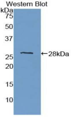 Invitrogen&trade;&nbsp;PTPRM Polyclonal Antibody