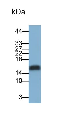 Invitrogen&trade;&nbsp;REG3B Polyclonal Antibody