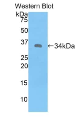 Invitrogen&trade;&nbsp;MT1E Polyclonal Antibody