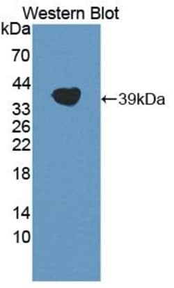 Invitrogen LPA Polyclonal Antibody 200 &mu;L; Unconjugated:Antibodies,