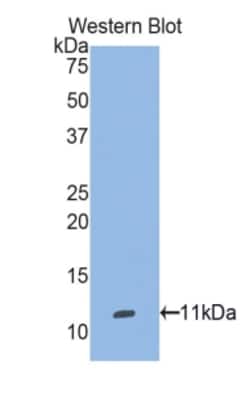 Invitrogen&trade;&nbsp;Selenoprotein W Polyclonal Antibody