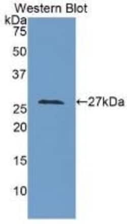 Invitrogen&trade;&nbsp;LOXL3 Polyclonal Antibody