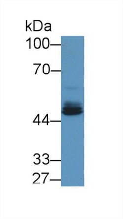 Invitrogen EGR2 Polyclonal Antibody 200 &mu;L; Unconjugated:Antibodies,