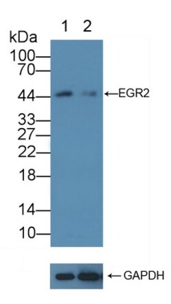 Invitrogen EGR2 Polyclonal Antibody 200 &mu;L; Unconjugated:Antibodies,