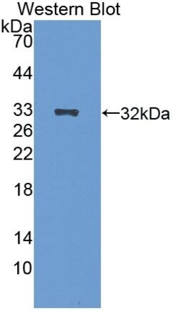 Invitrogen EGR2 Polyclonal Antibody 200 &mu;L; Unconjugated:Antibodies,