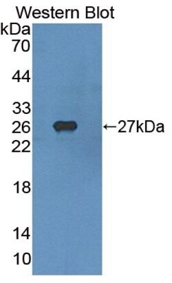 Invitrogen&trade;&nbsp;SREBP1 Polyclonal Antibody