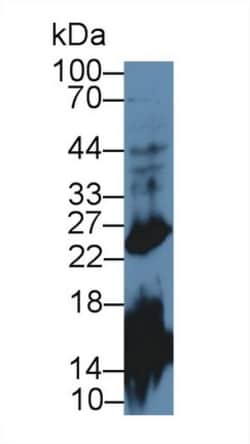 Invitrogen&trade;&nbsp;Growth Hormone Polyclonal Antibody