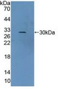 Invitrogen&trade;&nbsp;VWA2 Polyclonal Antibody
