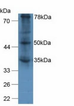 Invitrogen&trade;&nbsp;VWA2 Polyclonal Antibody