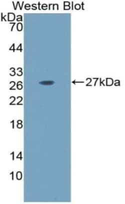 Invitrogen&trade;&nbsp;Laminin alpha-5 Polyclonal Antibody