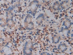 Invitrogen&trade;&nbsp;CD61 Polyclonal Antibody
