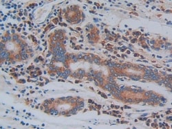 Invitrogen&trade;&nbsp;CD61 Polyclonal Antibody
