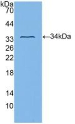 Invitrogen&trade;&nbsp;CD61 Polyclonal Antibody