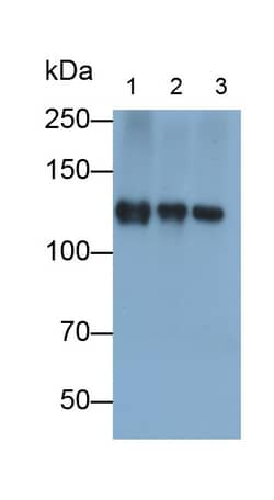 Invitrogen&trade;&nbsp;PDGFRA Polyclonal Antibody