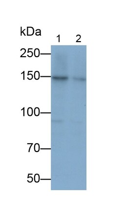Invitrogen&trade;&nbsp;PDGFRA Polyclonal Antibody