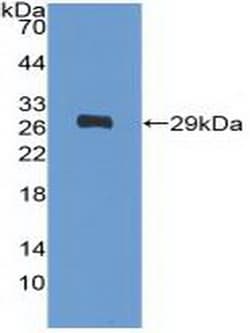 Invitrogen&trade;&nbsp;PDGFRA Polyclonal Antibody