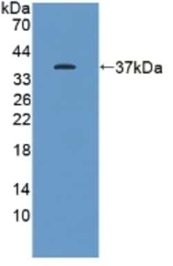 Invitrogen&trade;&nbsp;KEAP1 Polyclonal Antibody