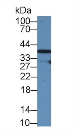 Invitrogen&trade;&nbsp;RAD51 Polyclonal Antibody