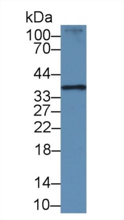 Invitrogen&trade;&nbsp;RAD51 Polyclonal Antibody