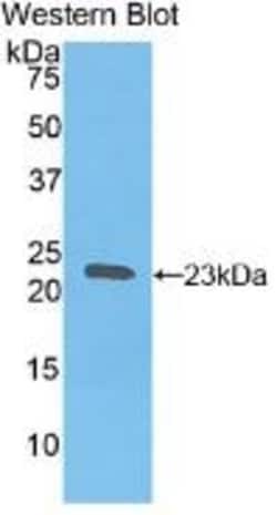 Invitrogen&trade;&nbsp;HBB Polyclonal Antibody